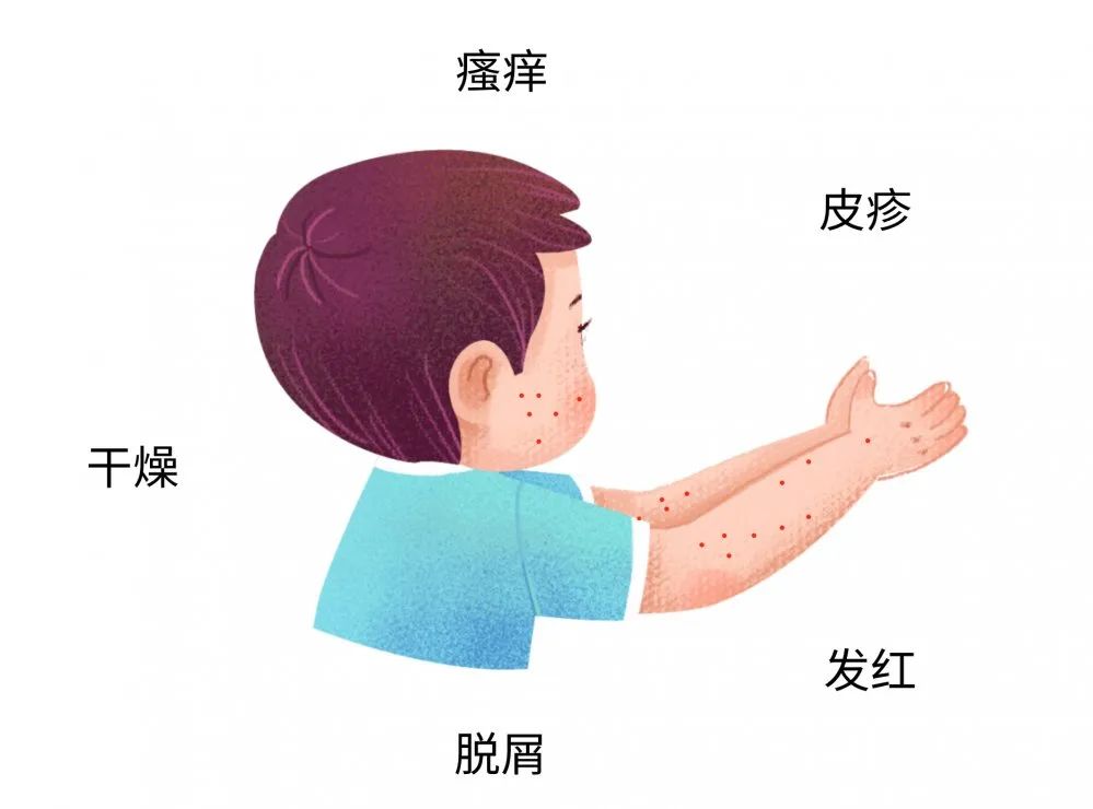 這些癥狀都可能是寶寶過(guò)敏傳遞的信號(hào)，很多寶媽還不知道